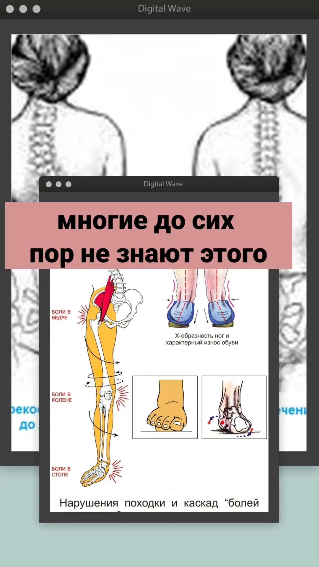 Остеопаты уделяют большое внимание стопам пациента и совсем не случайно. Травмы ног/стоп влияют на в