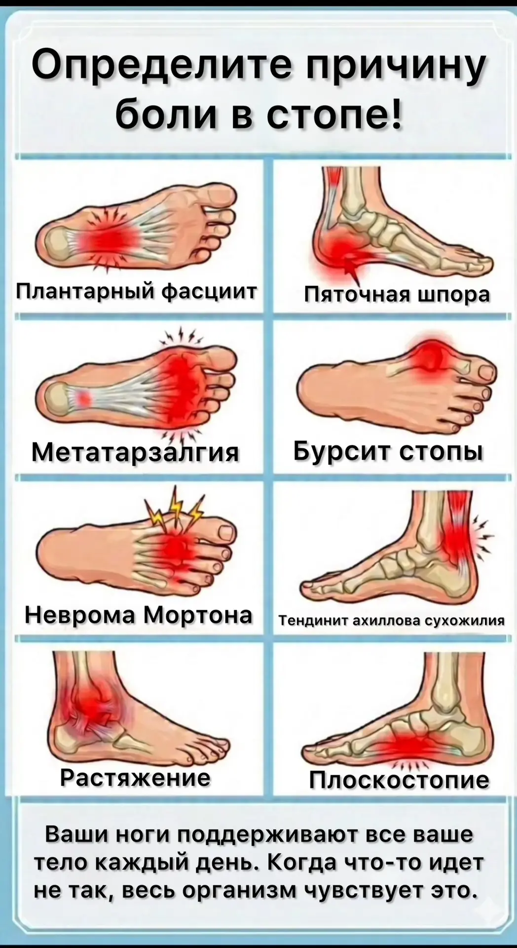 🦶 Определите, где у вас болят ноги!