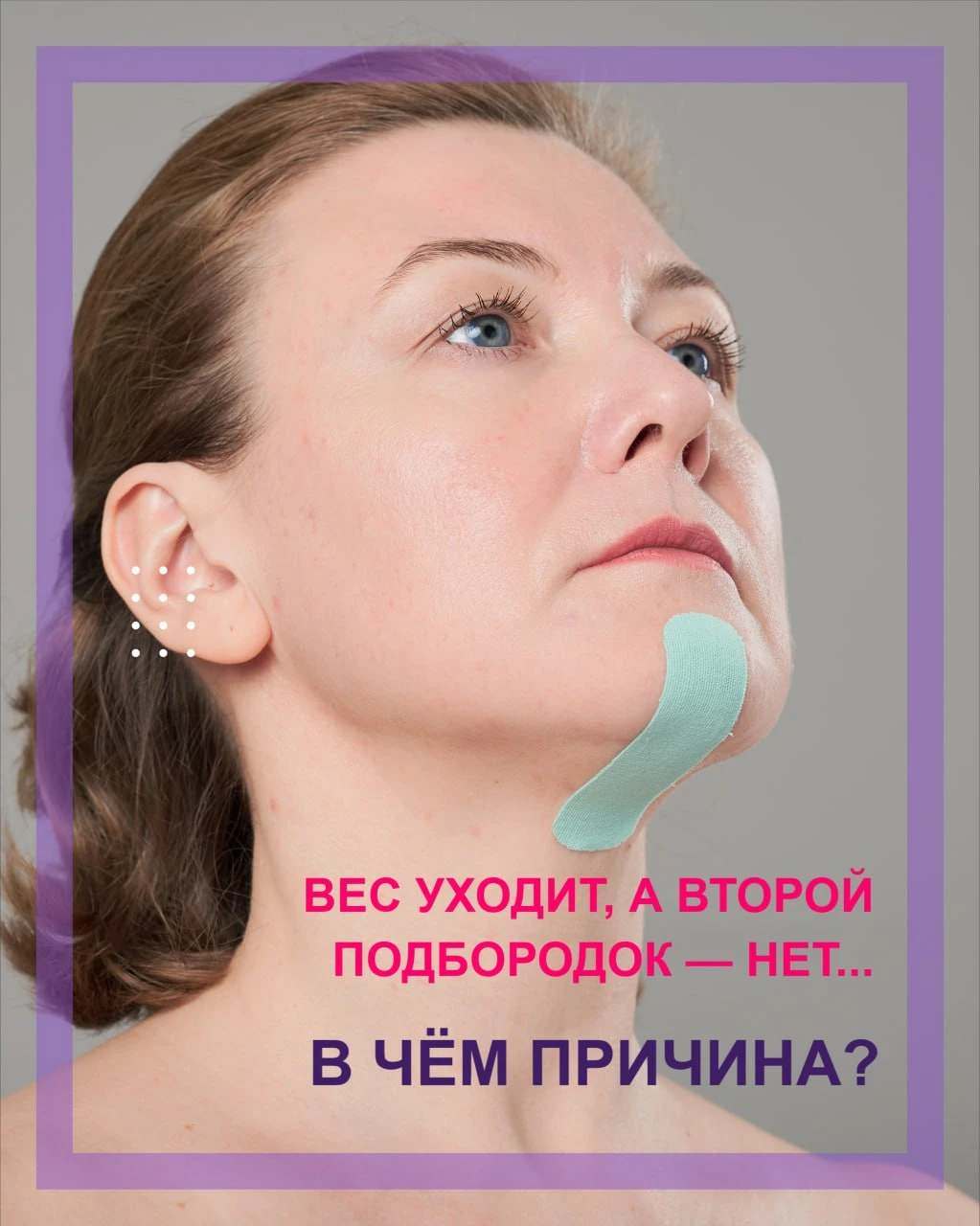 Я худею, но второй подбородок не уходит. Что с этим делать?