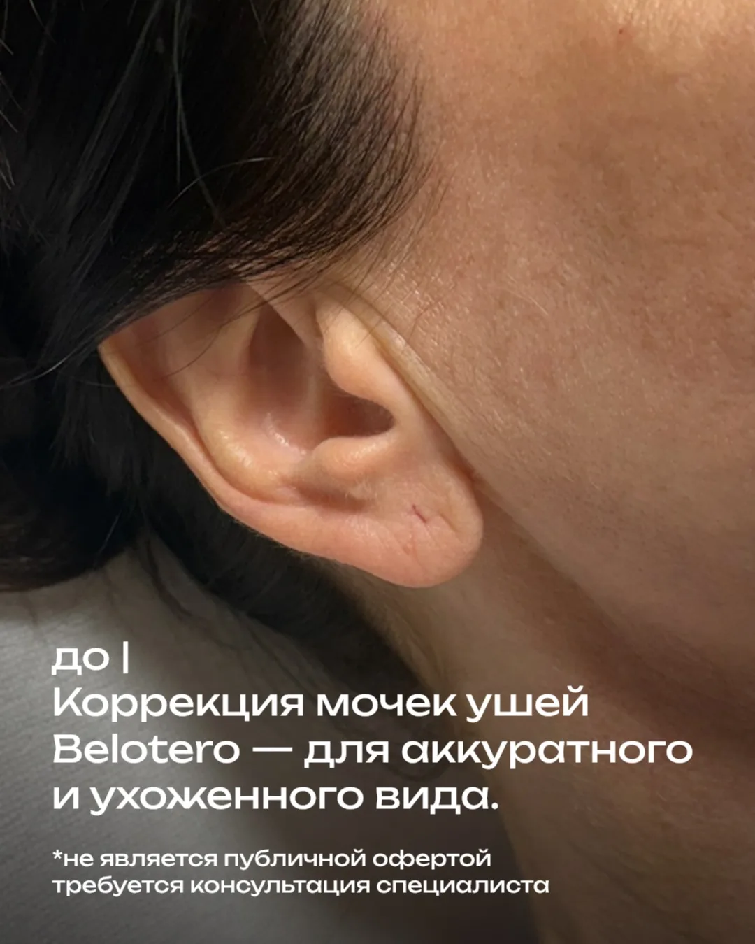 Задать волнующие вопросы или записаться можно через личные сообщения https://max.ru/u/f...