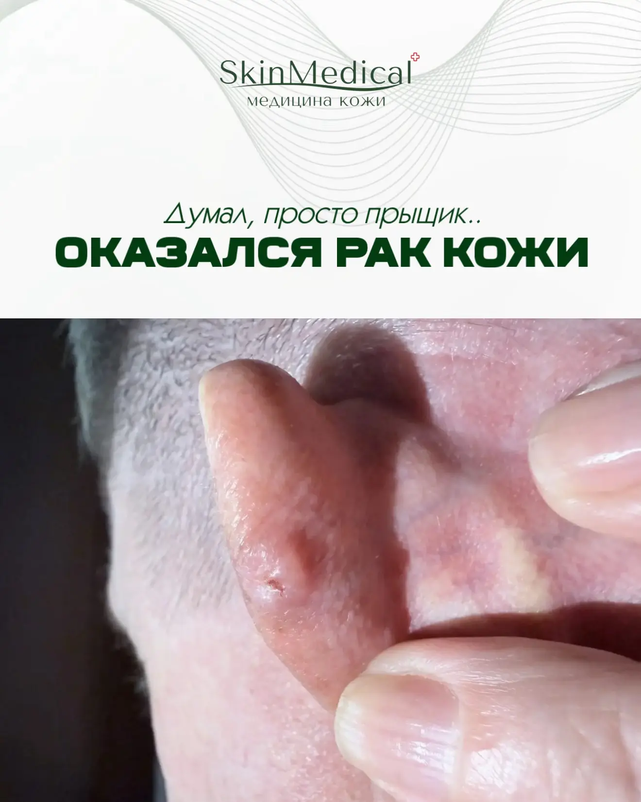 Клинический случай 👆 результат гистологии вас удивит..