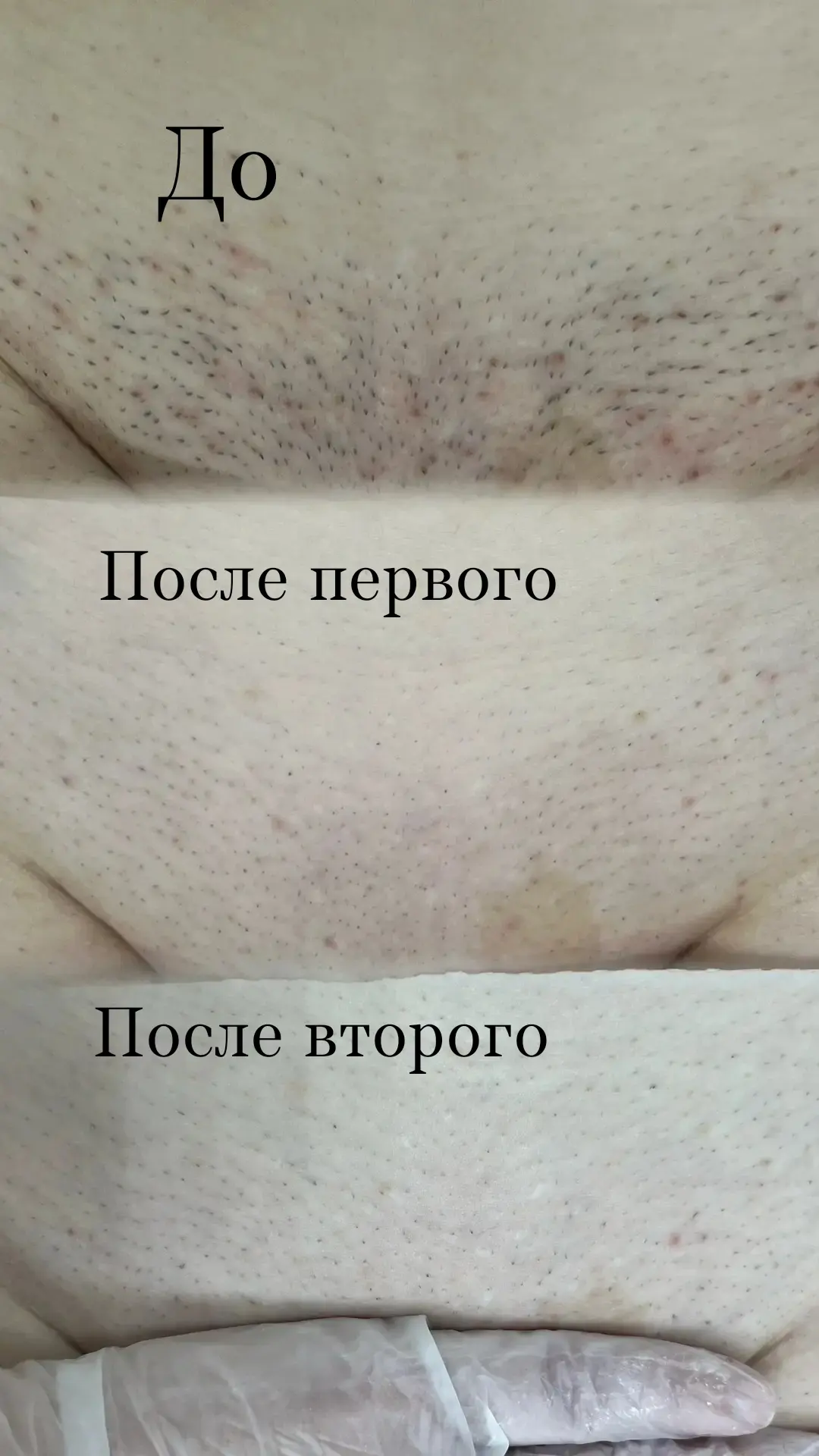 Лазерная эпиляция и уход за лицом — делаю то, что люблю, и отвечаю за результат 🤍