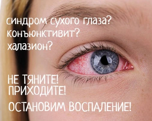 ‍🔴 Покраснел глаз? Это не усталость. Три болезни с одним симптомом.