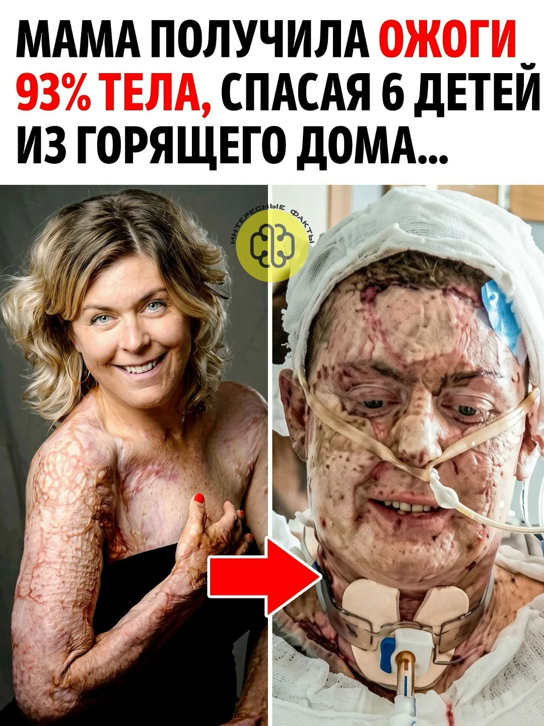 В сентябре 2019 года в доме Эммы Шольс в шведском Эдсбюне начался пожар. В тот момент о...