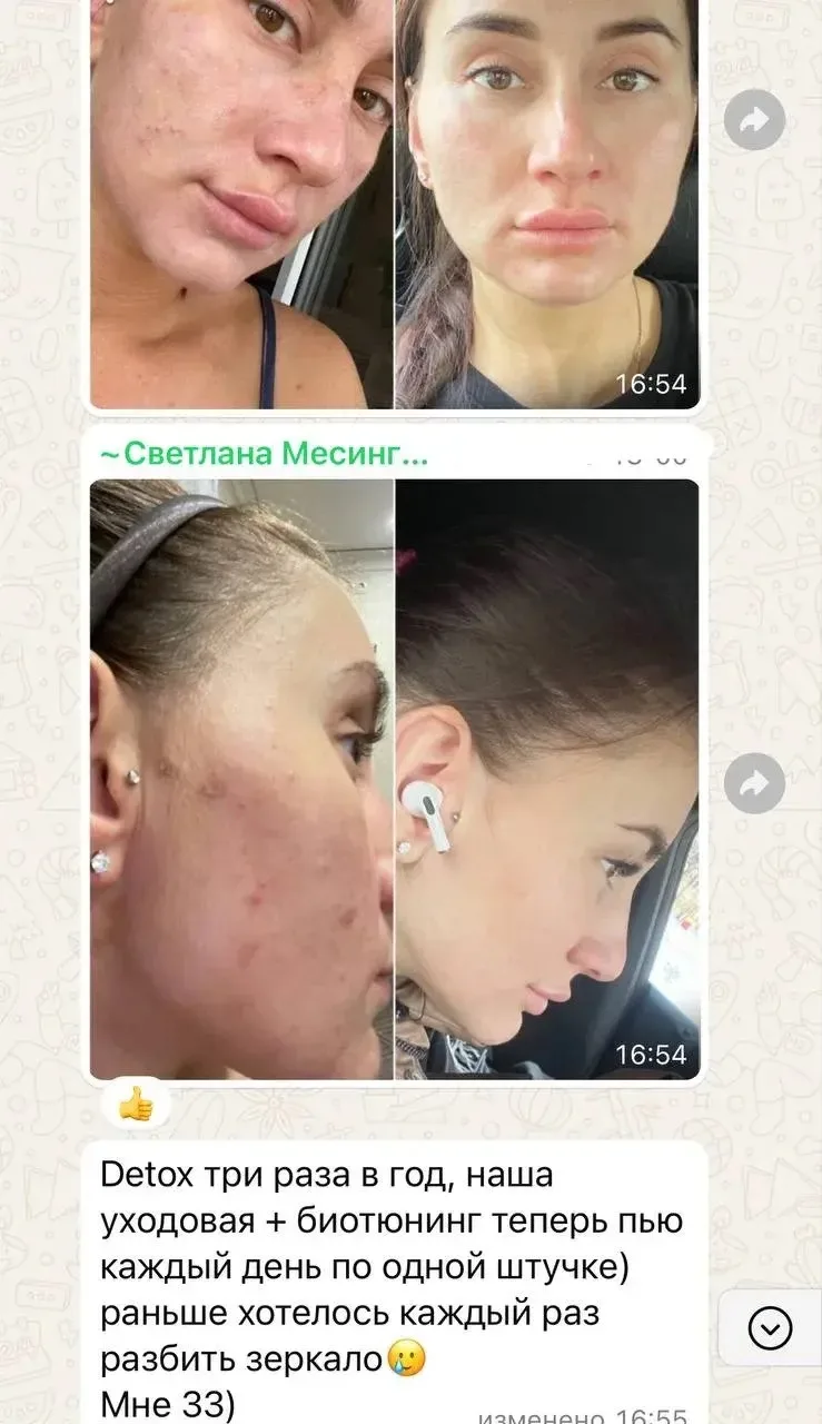 Кожа становится чище, воспалений меньше, уход начинает давать совсем другое ощущение, м...