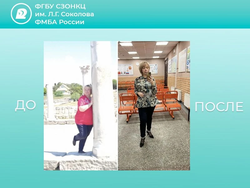 👏 Минус 48 кг — результат совместной работы бариатрической команды и пациентки