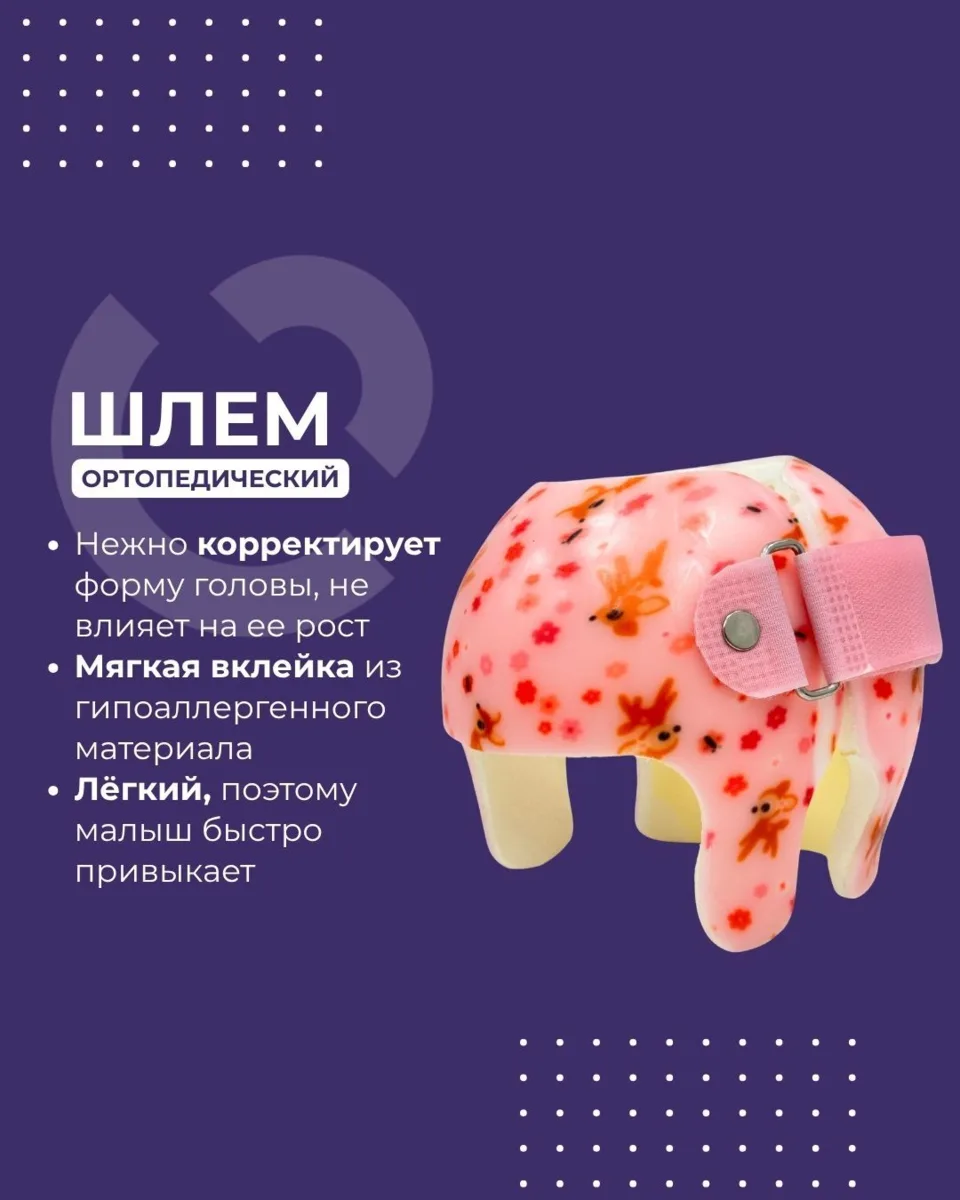 Как ухаживать за ортопедическим шлемом? 👶