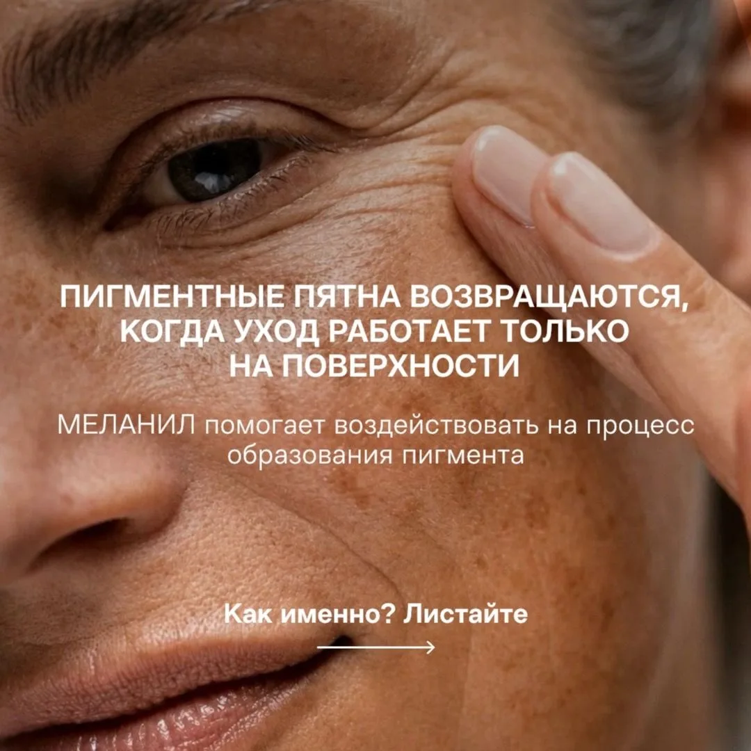 Почему пигментные пятна возвращаются — разбирали в прошлый раз.
