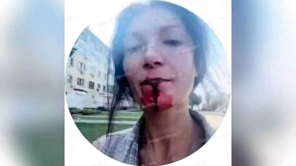😨 В Воронеже мужчина ударил скейтом девушку, которая заступилась за его жену.