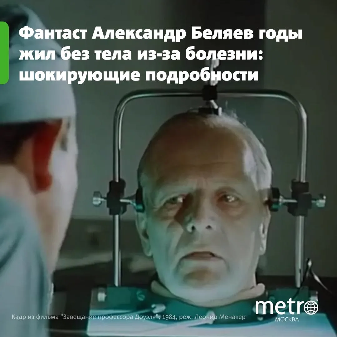 🧠 Голова без тела: подробности страшного состояния фантаста Александра Беляева