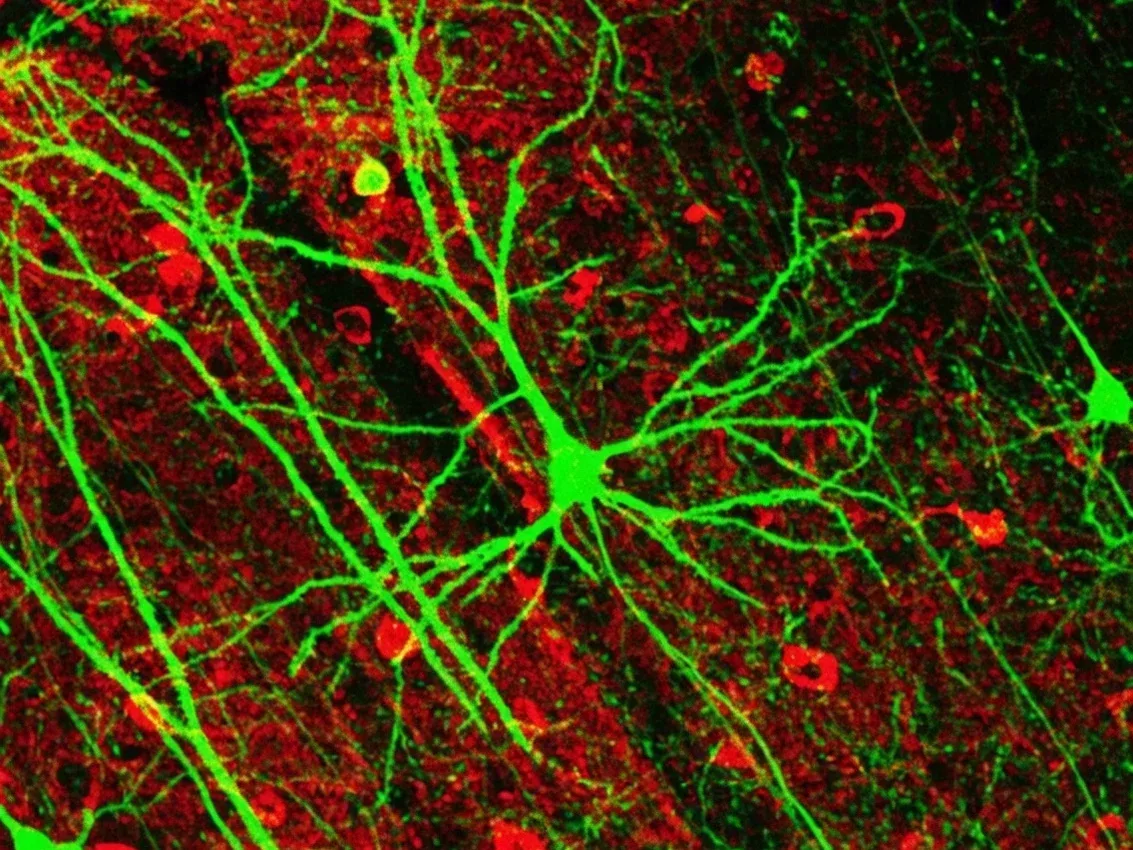 🧠 В мозге нашли нейроны, которые помогают не сдаваться
