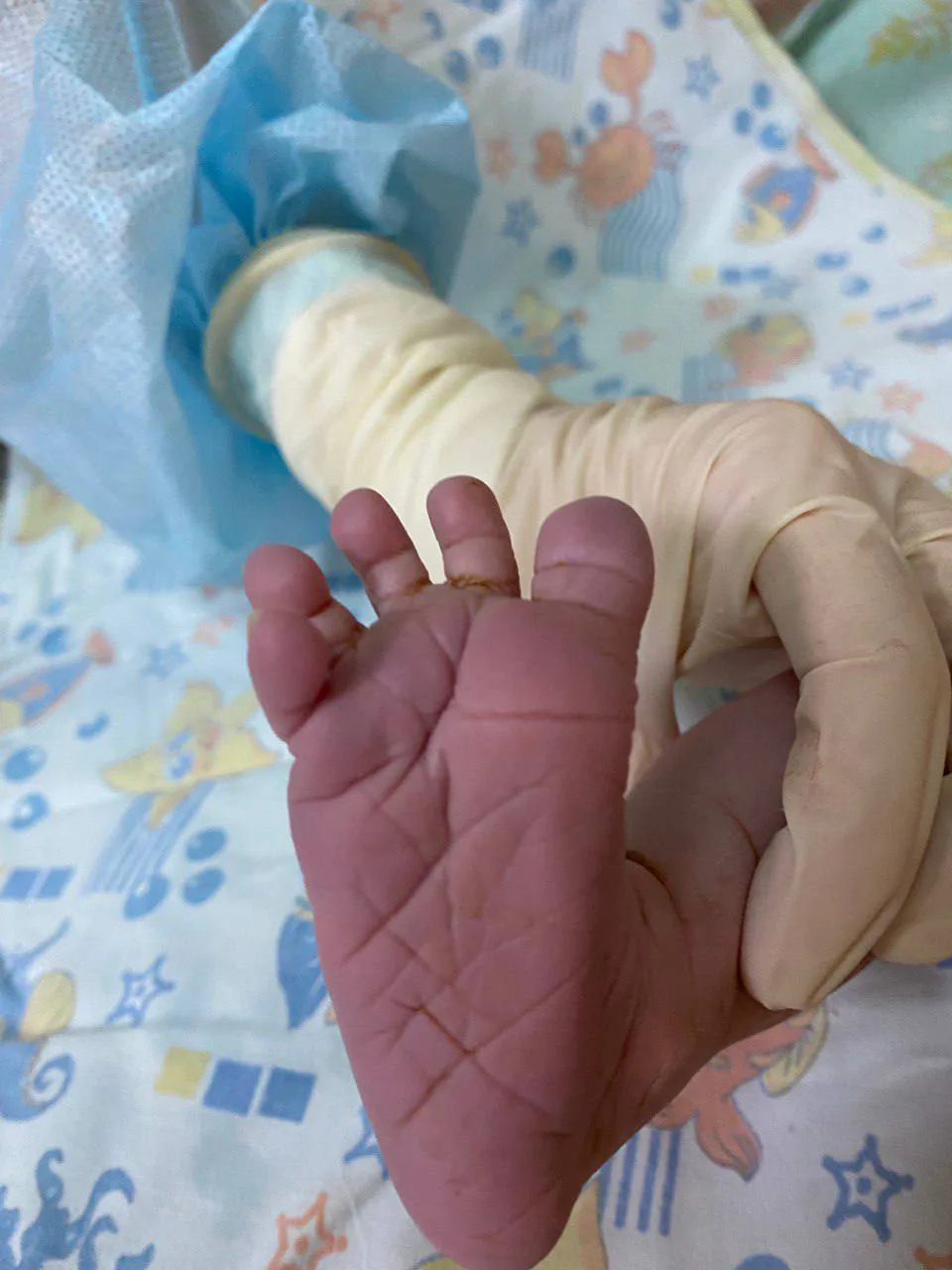 Не стоит тревожиться! 

После излития вод, малыш продолжает получать кислород через пуповину✔️, и да