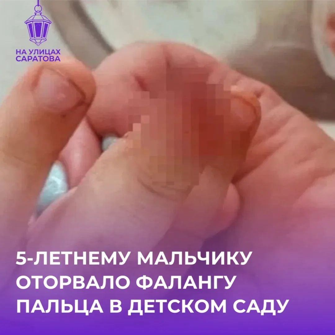 😱Ребенку оторвало фалангу пальца в детском саду Энгельсского района

Историей в соцсетях поделилась