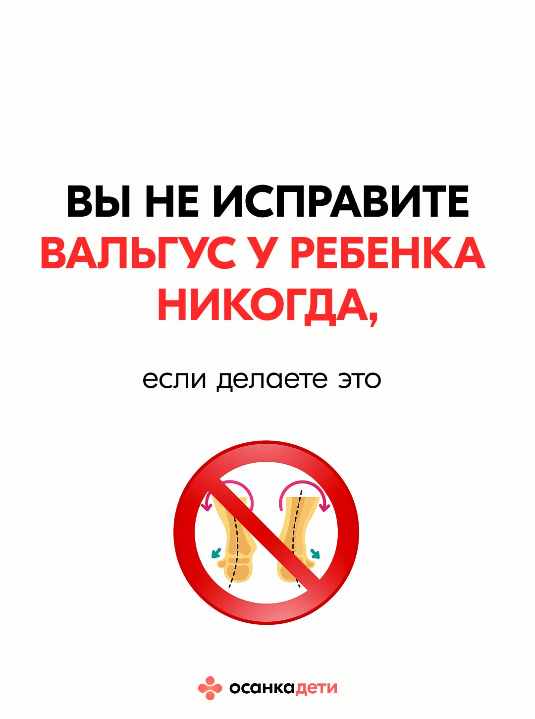 Что МЕШАЕТ исправить вальгус (и почему вы до сих пор топчетесь на месте)  «Мы уже год в ортообуви — 