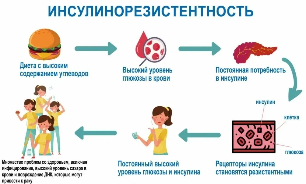 Инсулинорезистентность: один корень для давления, жирового гепатоза и лишнего веса