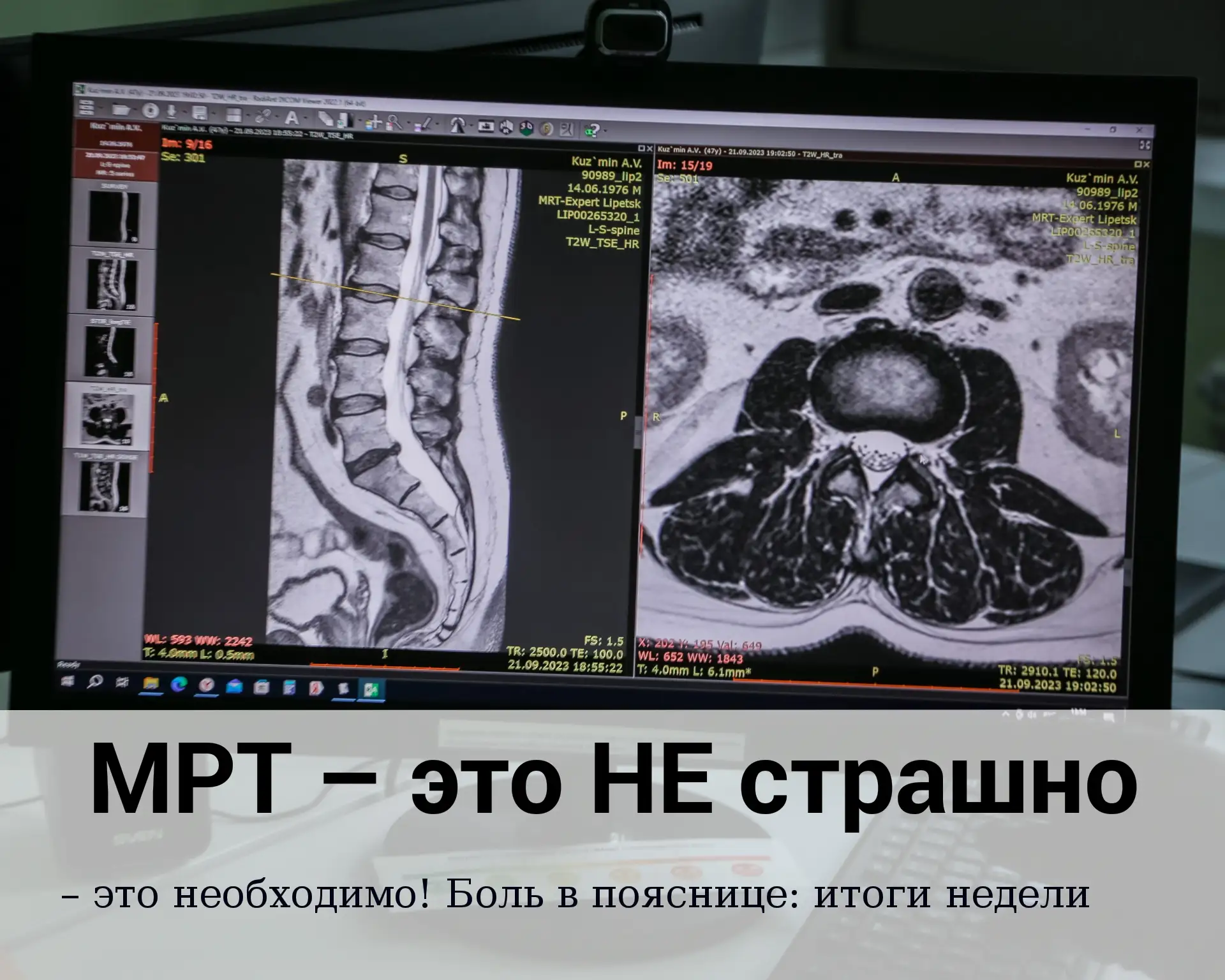 Боль в пояснице: итоги недели. МРТ — это не страшно, это необходимо