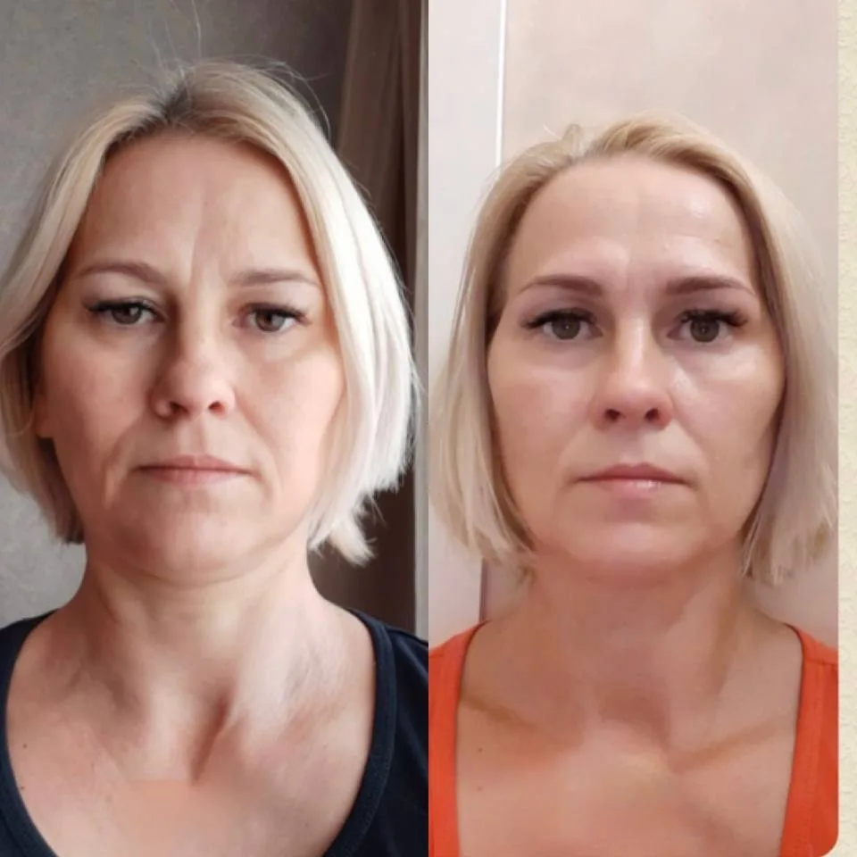 ВЫГЛЯДЕТЬ МОЛОДО НЕ ПОЛУЧИТСЯ, ЕСЛИ НЕ ЗНАТЬ ЭТОГО☝️  🤔 Что старит нас раньше срока? Что деформирует