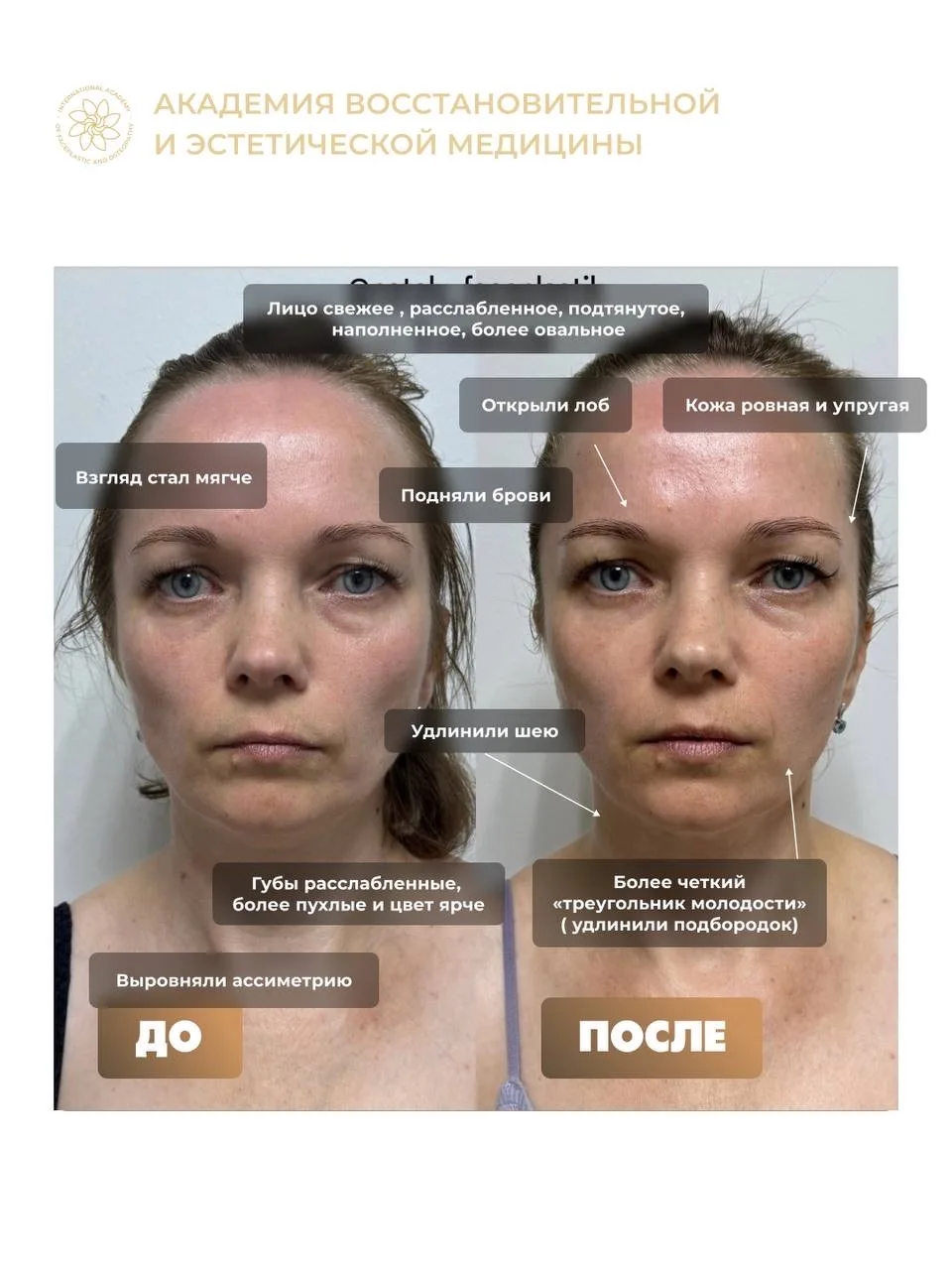 ❌ NO ОГРАНИЧЕНИЯМ! Из найма в фuнaнсовую свободу, признание и счастье 🤩  Сегодня расскажем про вдохн