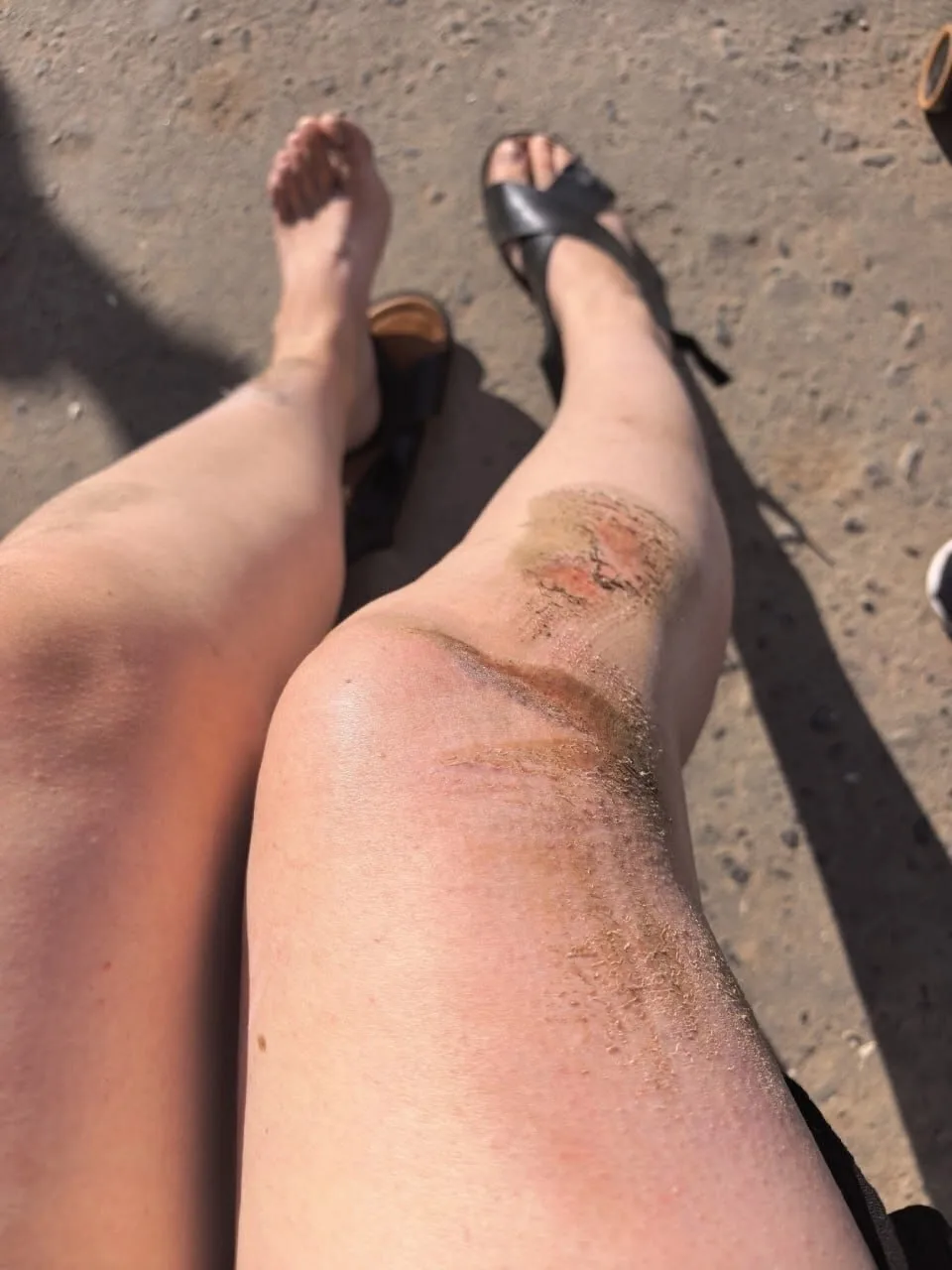 Я бежала за автобусом и упала, что это вообще такое? Не верю, что водитель этого не заметил, а пасса