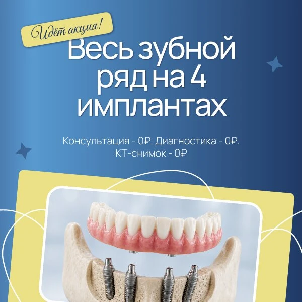 Все зубы за 1 день! 4-х импланта + протез от 94 900 ₽.