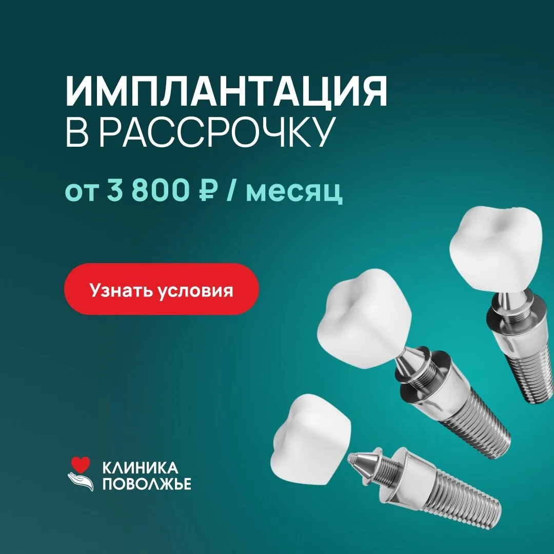 Цена имплантации пугает? От 3 800 ₽ в месяц