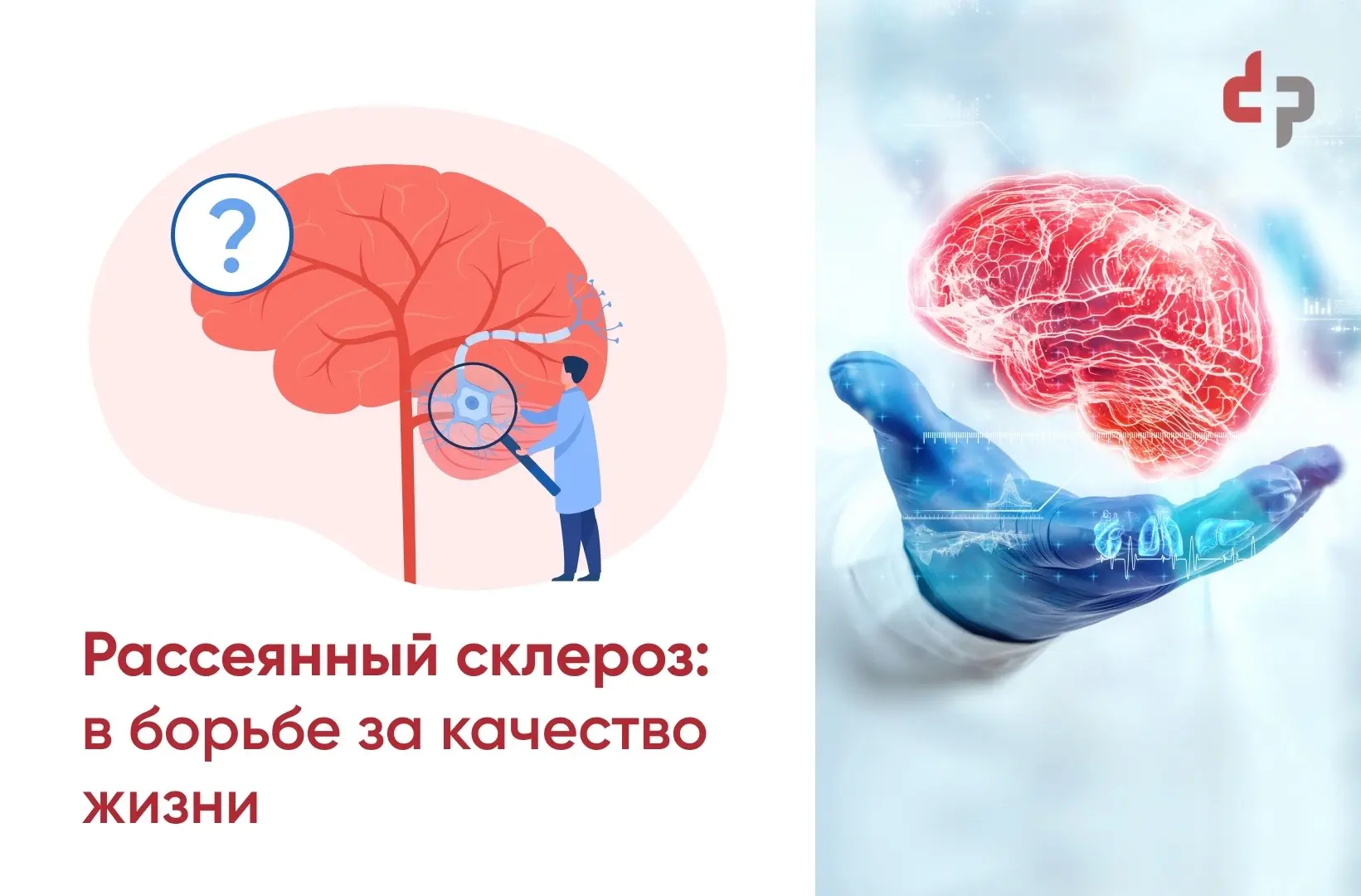 27 мая – Всемирный День борьбы с рассеянным склерозом.