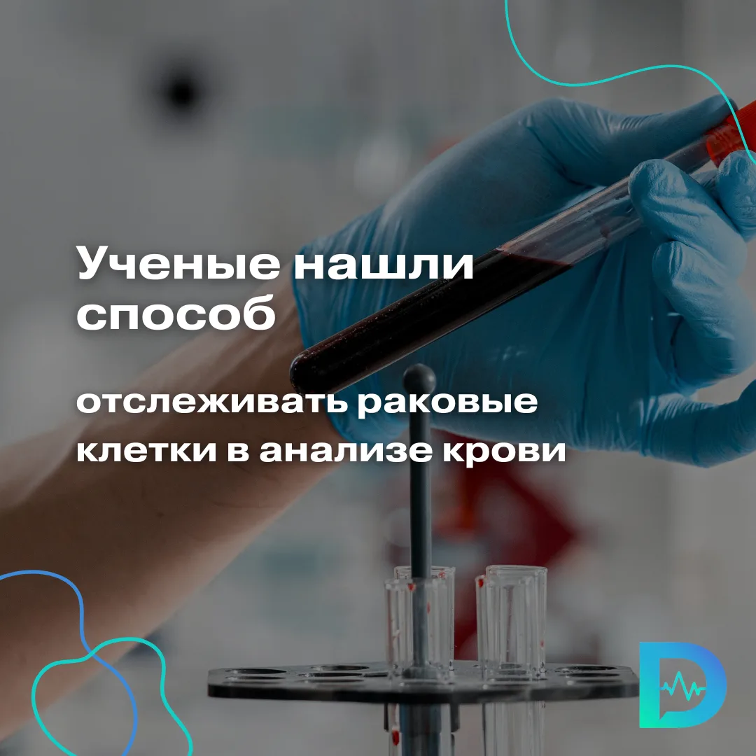 Учёные нашли способ отслеживать раковые клетки в анализе крови.