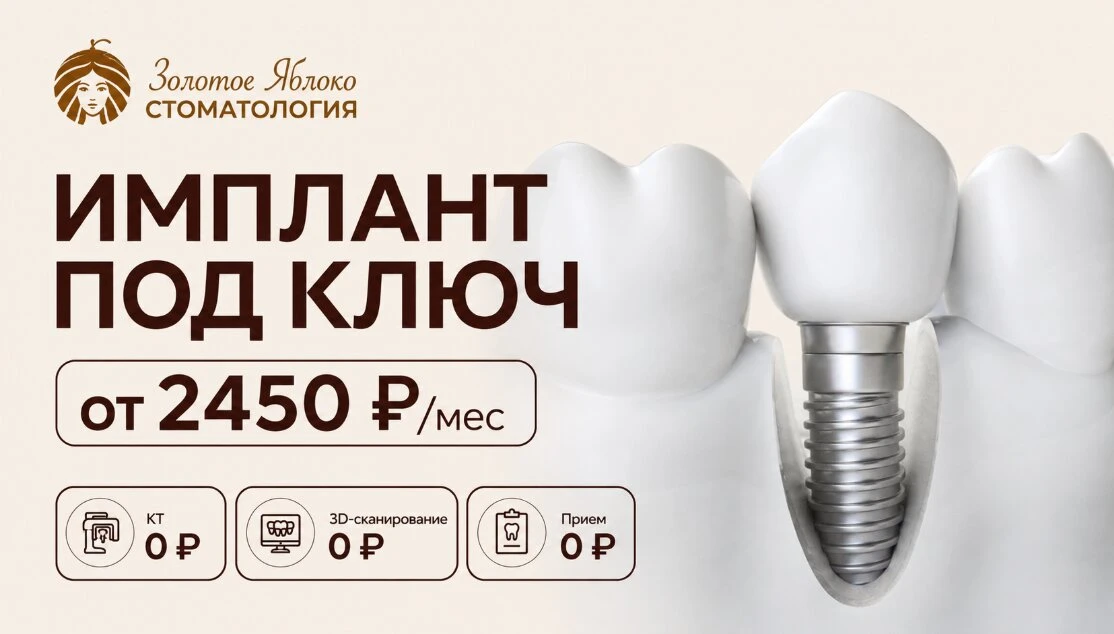 Имплант "под ключ" от 2 450₽ в месяц