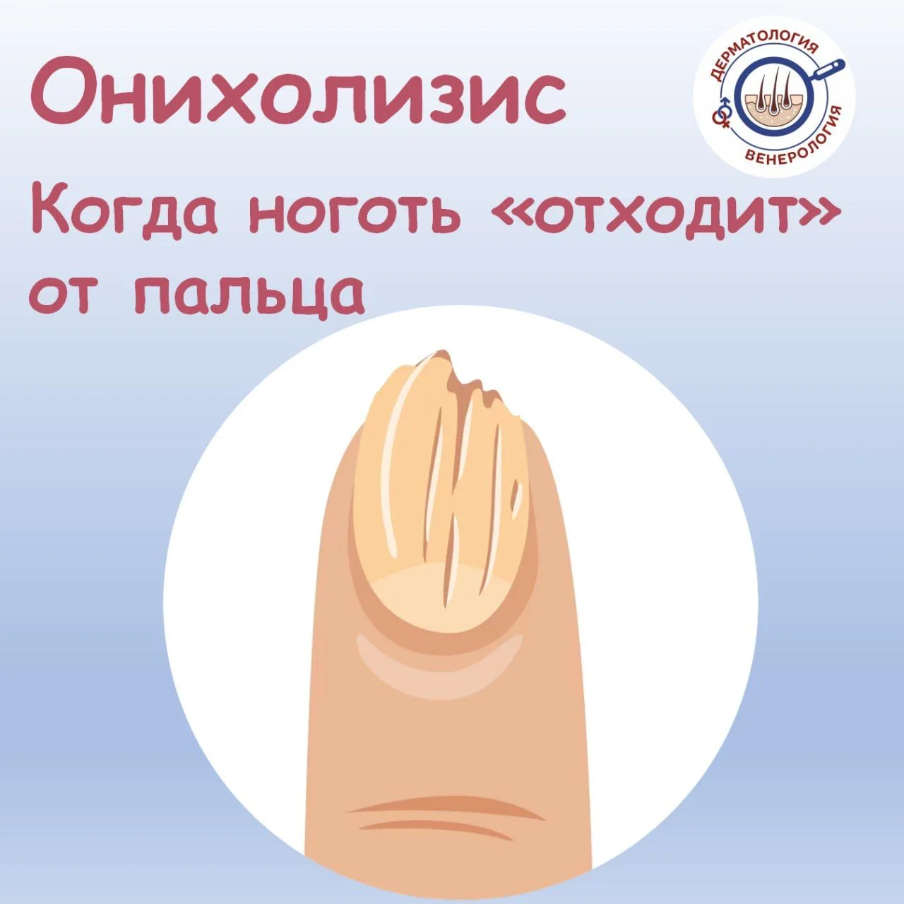 Вы смотрите на свои ногти и замечаете, что у одного из них изменился цвет — он стал жел...