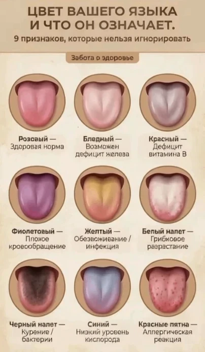 ТВОЙ ЯЗЫК МОЖЕТ КРИЧАТЬ О ПРОБЛЕМАХ В ОРГАНИЗМЕ — А ТЫ ЭТО ДАЖЕ НЕ ЗАМЕЧАЕШЬ.