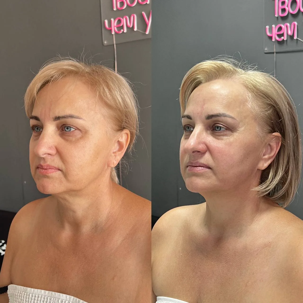 Готовы к потрясающему преображению? 😍 Мой уникальный массаж лица — это ваш… — публикация канала «Доска Лабинск»