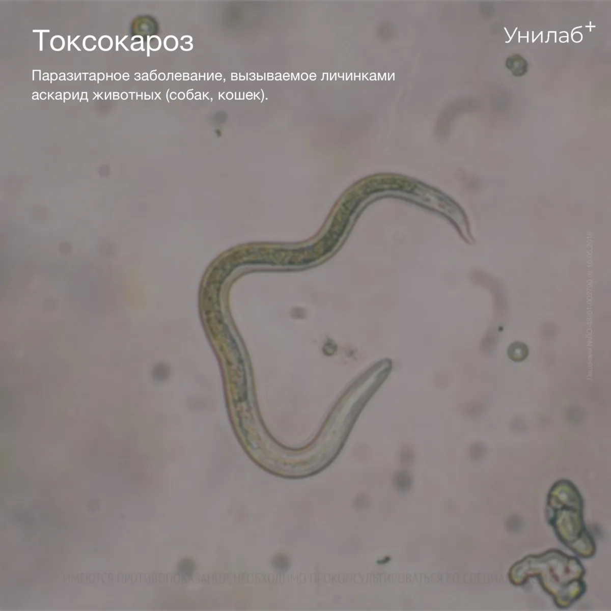 🪱 Гельминты (токсокары, эхинококки, описторхисы, трихинеллы)