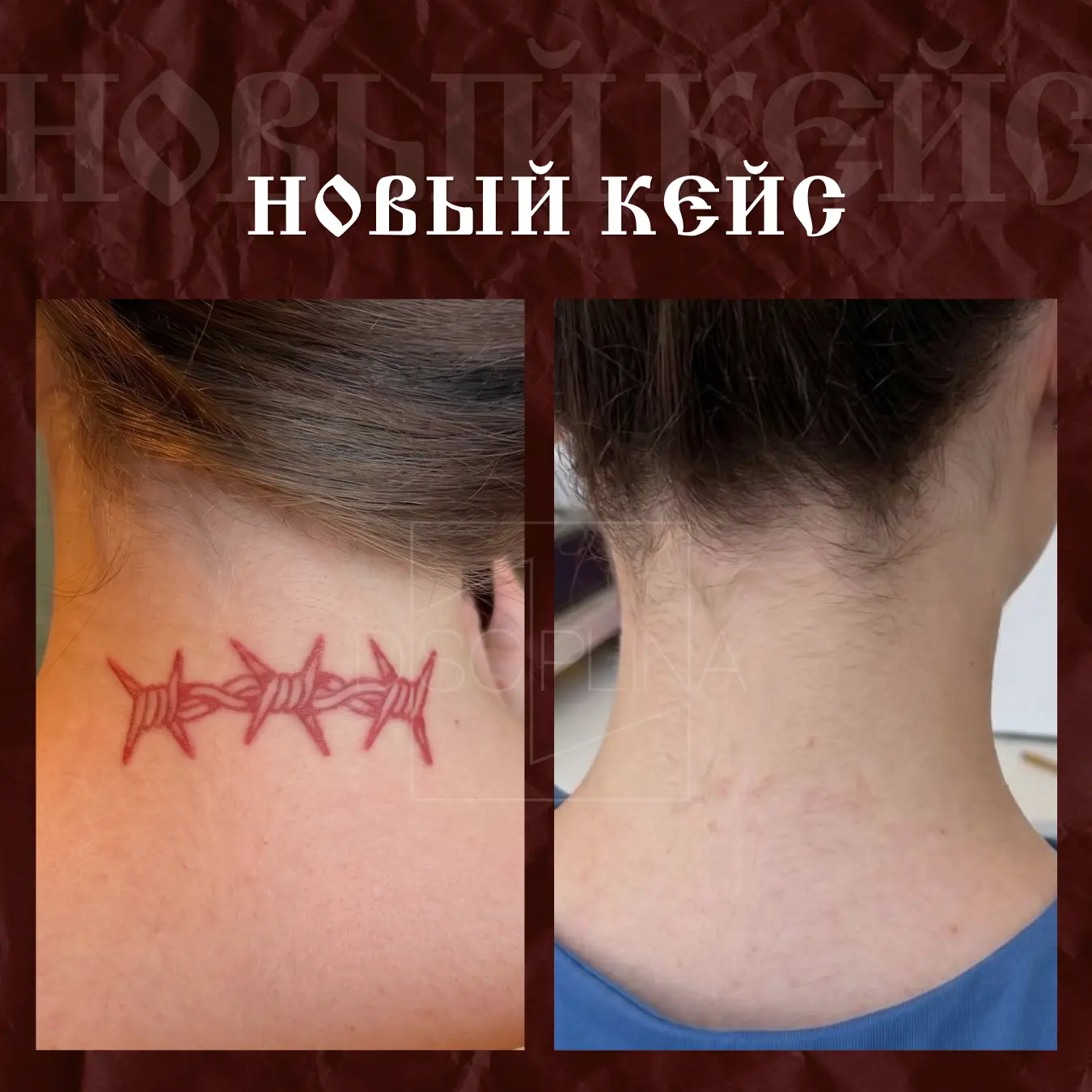 🔴 А вот и тот самый кейс с КРАСНЫМ пигментом.