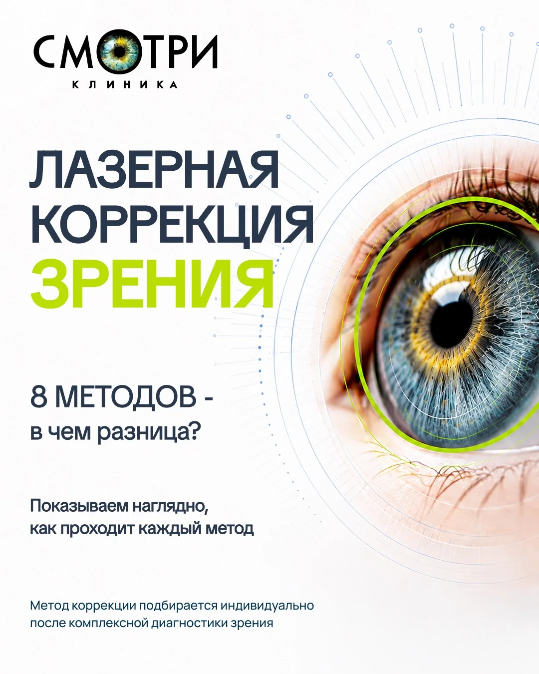 Сегодня разберём вместе 8 методов лазерной коррекции зрения, которые мы выполняем в наш...