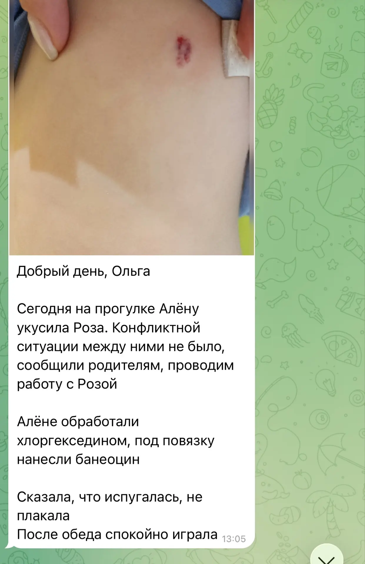 Вчера Аленку укусили в саду.
Воспитатель сразу сообщила, извинилась, рану обработали.

На самом деле