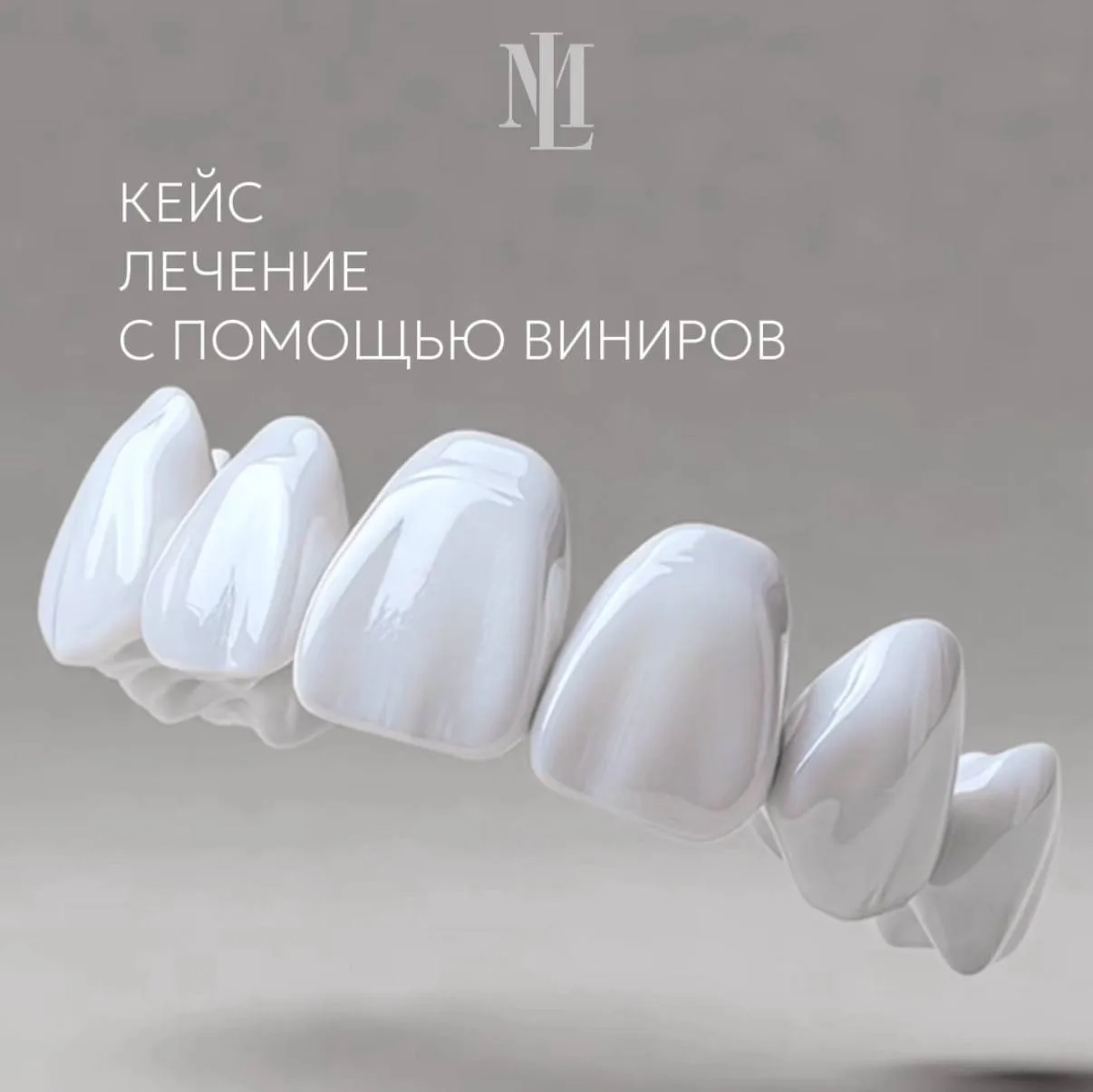 Преображение улыбки — это всегда индивидуальная работа.