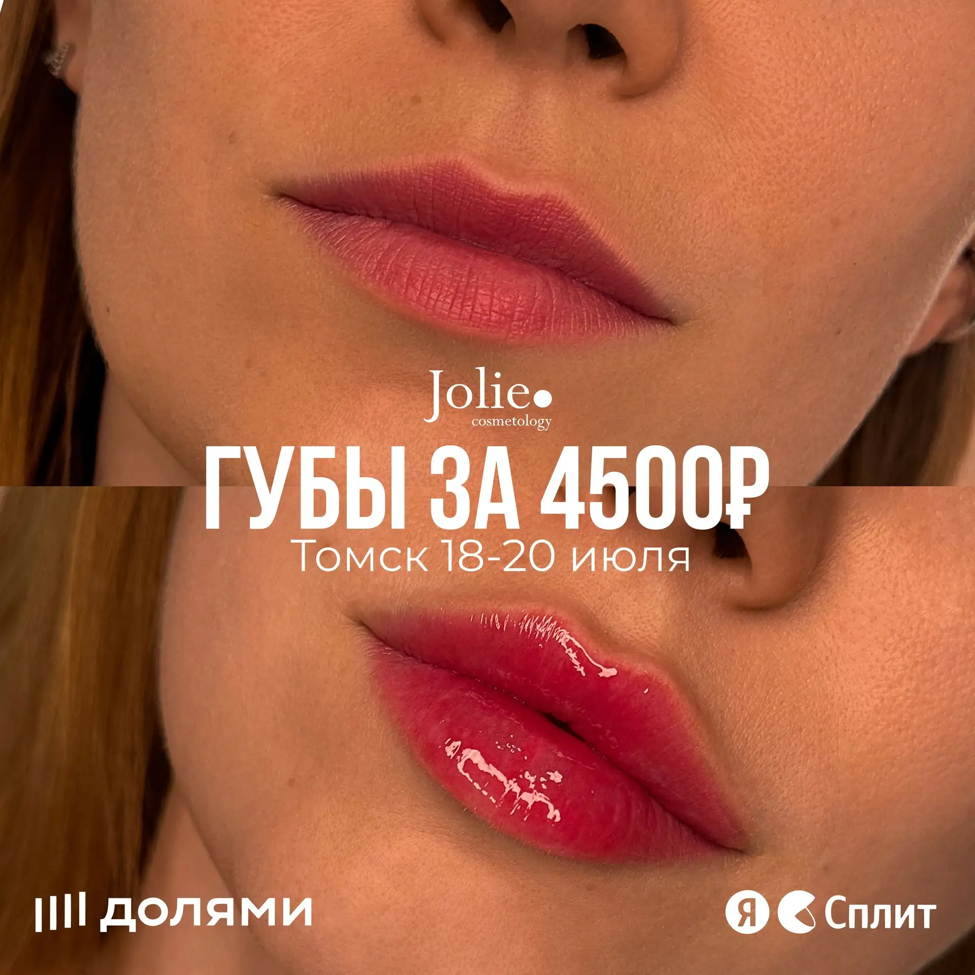 Изображение 1 к публикации «Центр косметологии Jolie»