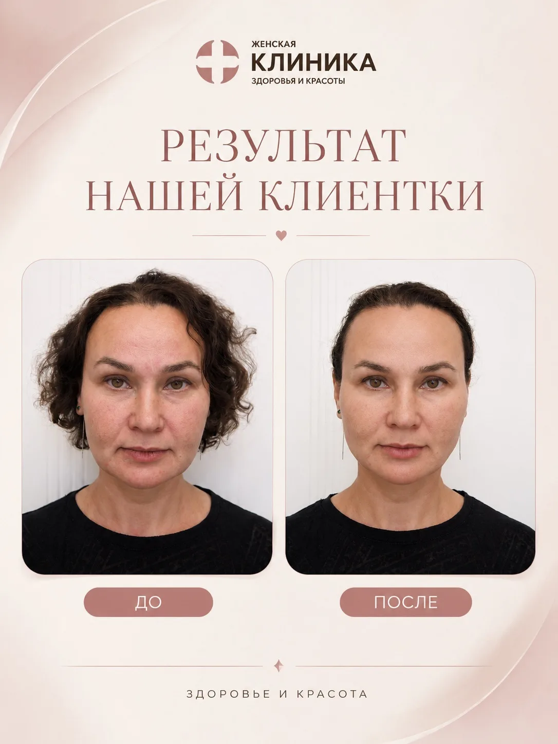 Иногда одного метода недостаточно, чтобы получить действительно красивый и гармоничный ...