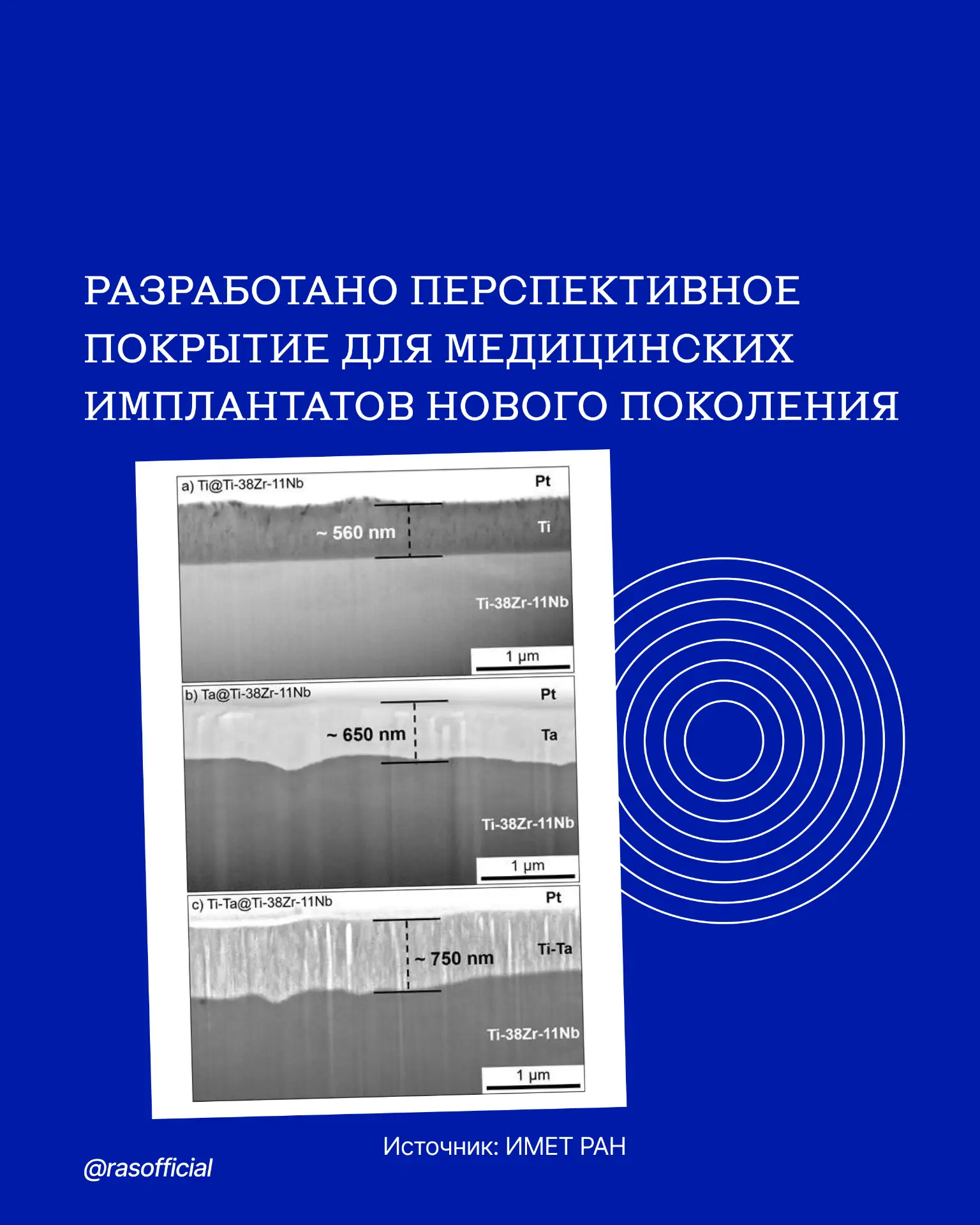 Разработано перспективное покрытие для медицинских имплантатов нового поколения

Учёные из Института