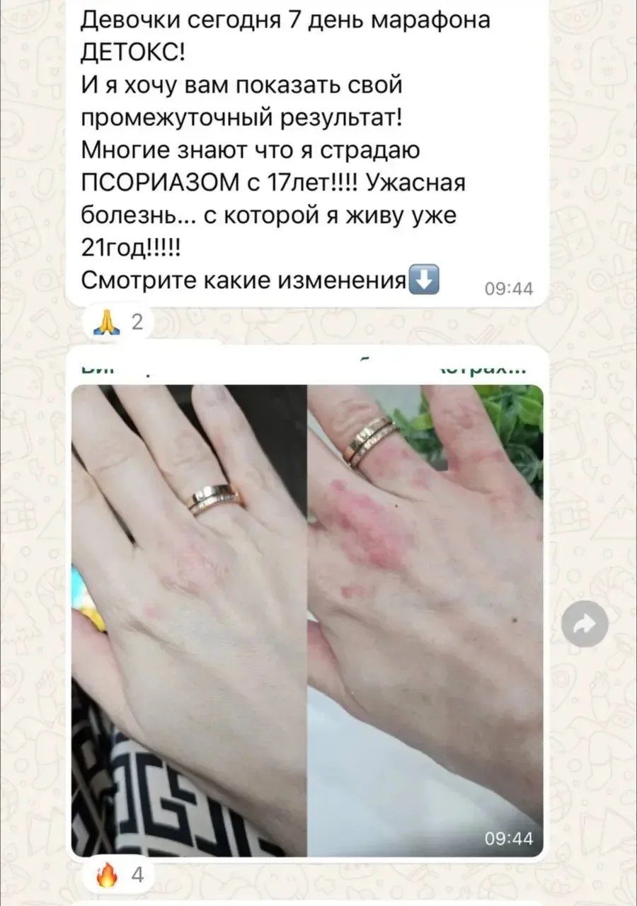 Результат марафона Детокс 🔥