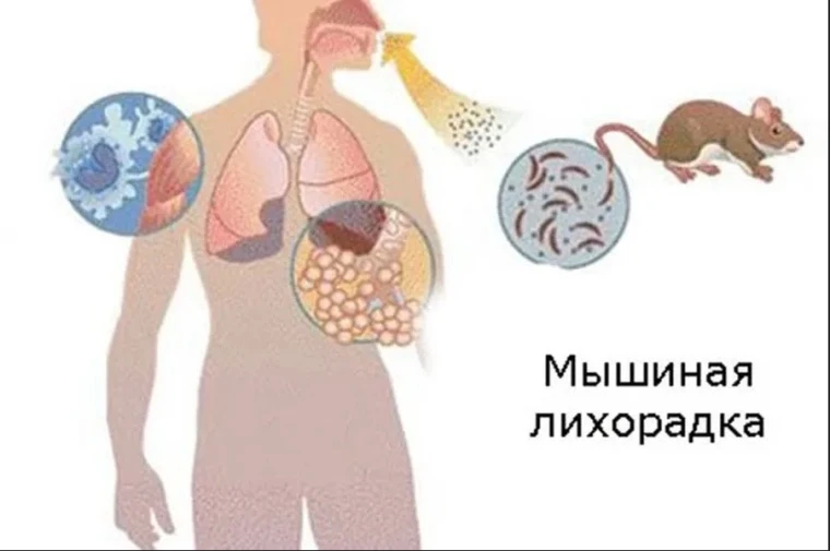 🐁 В Татарстане вдвое выросла заболеваемость мышиной лихорадкой

В Роспотребнадзоре сообщили, что ин