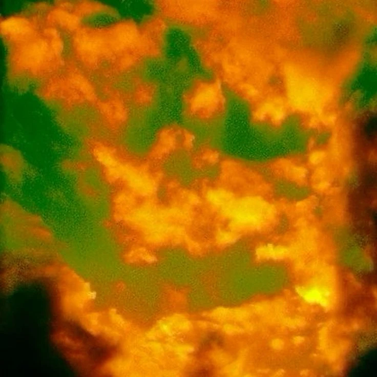 💚🧡💚
