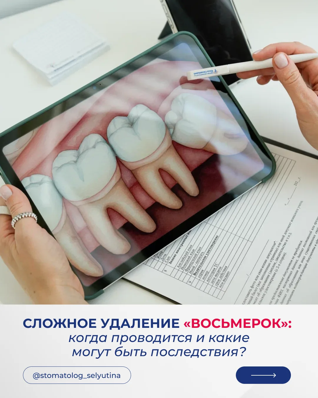 В Центре стоматологии Юлии Селютиной мы не работаем вслепую.

🔹 КТ на входе — видим нерв насквозь в