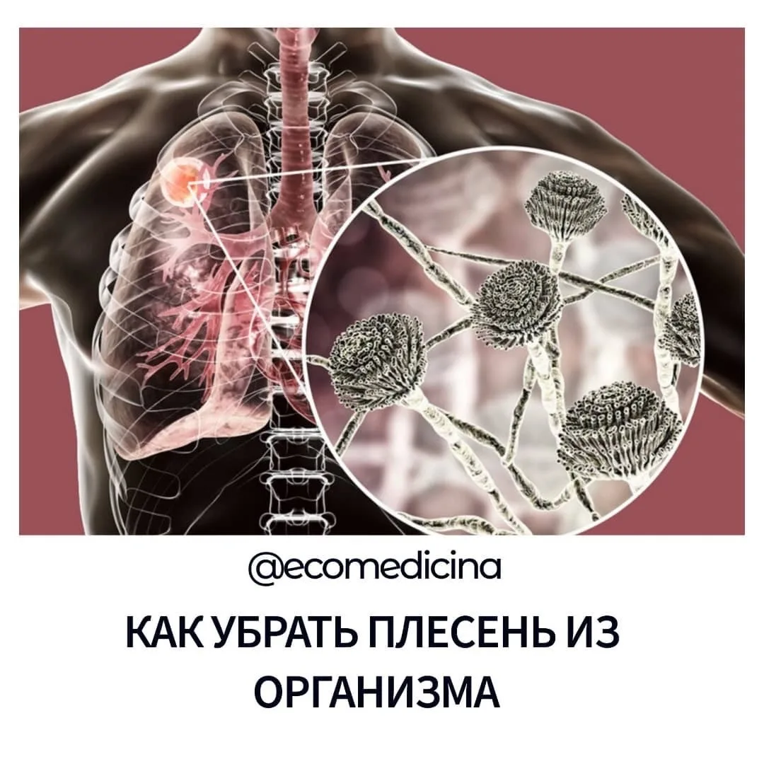 ⚫👀КОГДА МЫ ПОДВЕРГАЕМСЯ ВОЗДЕЙСТВИЮ ПЛЕСЕНИ, НАША ИММУННАЯ СИСТЕМА ПЕРЕГРУЖАЕТСЯ, и на...