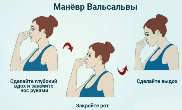 Лайфхак для тех кто летит в отпуск в ближайшее время — как быстро выровнять давление в ушах при взлё