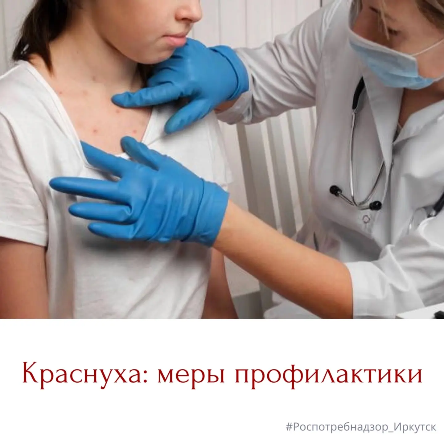Краснуха - острое вирусное инфекционное заболевание, с воздушно-капельным путем передачи.