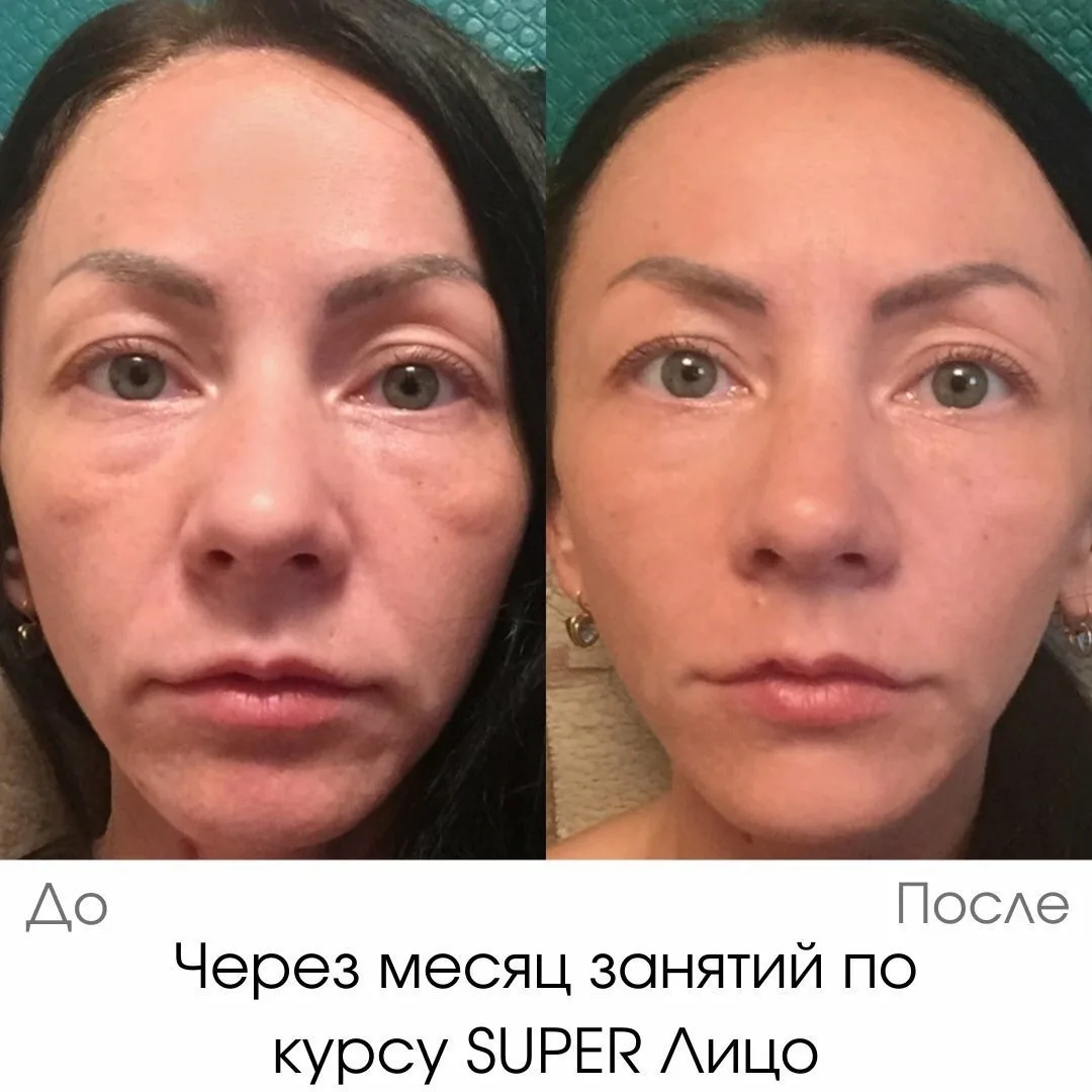 😓 Некоторые женщины годами пытаются убрать мешки под глазами, а потом оказывается, что...