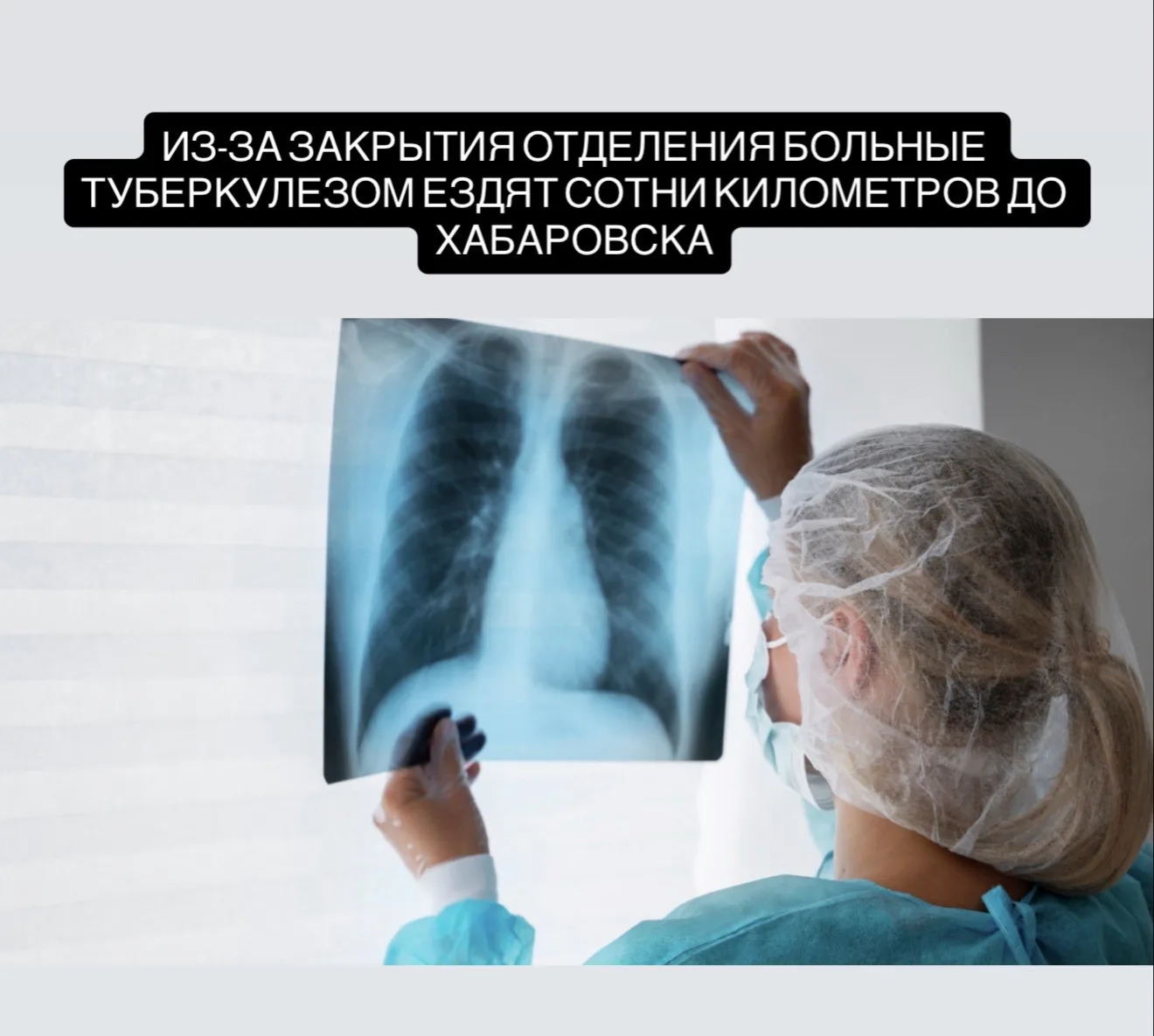 В посёлке Чегдомын с января закрыто туберкулёзное отделение, несмотря на то что здание ранее отремон