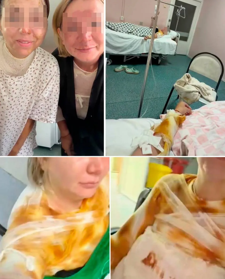 ⚡️ Взорвавшаяся скороварка обожгла двух девушек из Ярославской области, — СМИ.