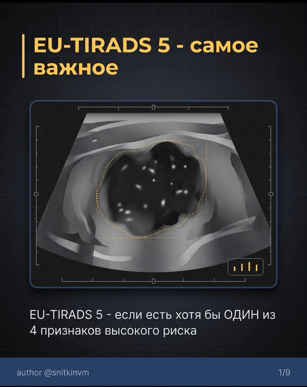 EU-TIRADS 5